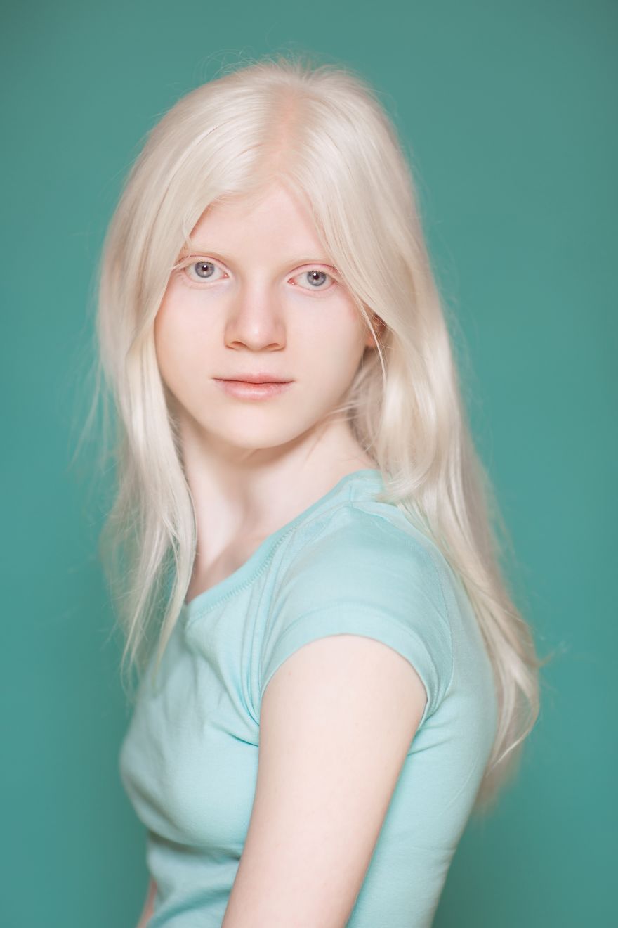 We Took Photographs Of Albino Kids To Show Their Pure Beauty We Took Photographs Of Albino Kids To Show Their Pure Beauty