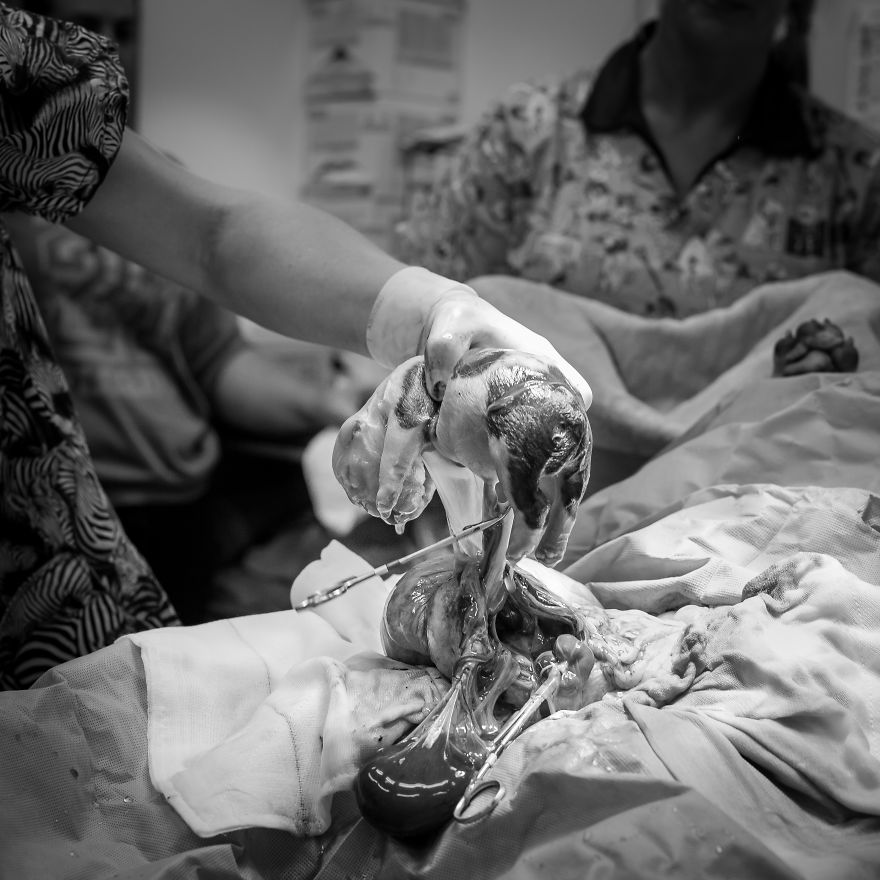 I Documented Bulldog C-Section