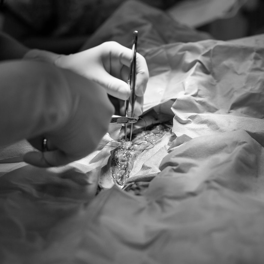 I Documented Bulldog C-Section