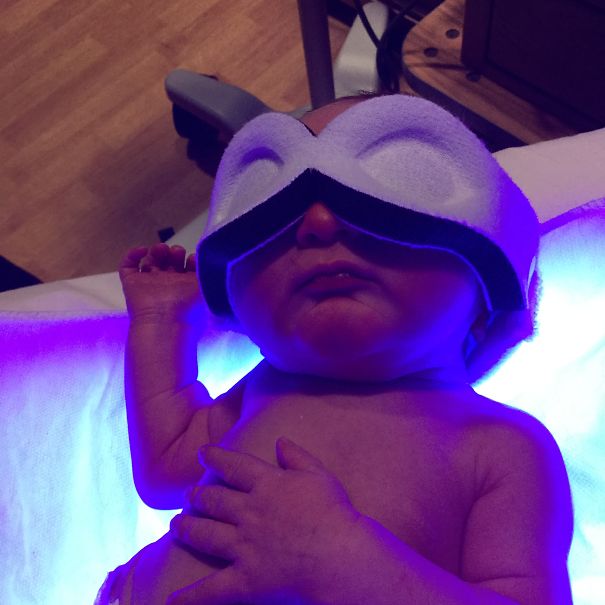 Making Sure Baby Has That Nice Tan Before Leaving Hospital.