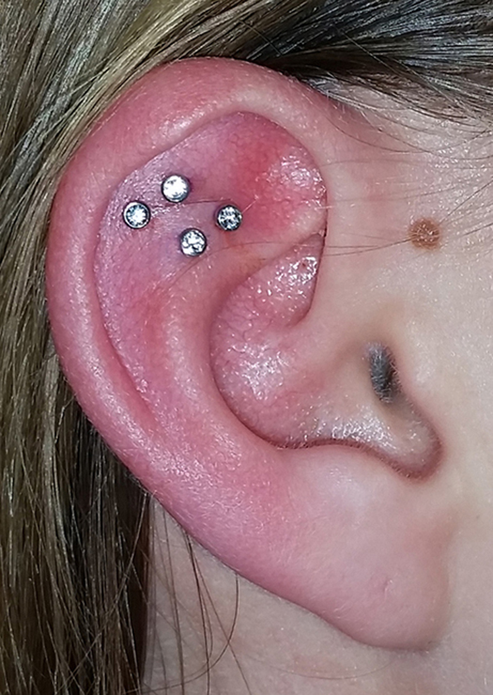 Quadruple Outer Conch