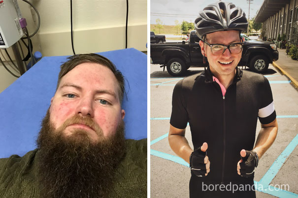 Before-and-after of a man: on a hospital bed and later outside in cycling gear after quitting drinking.
