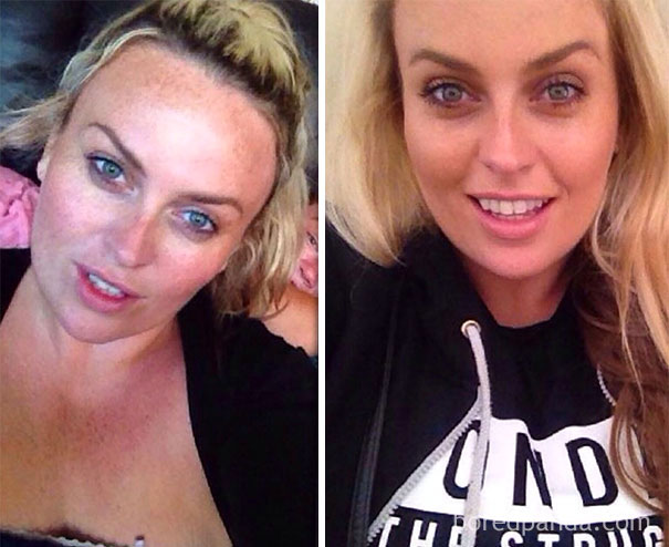 Before and after photos showing the impact of quitting drinking, highlighting positive changes in appearance.