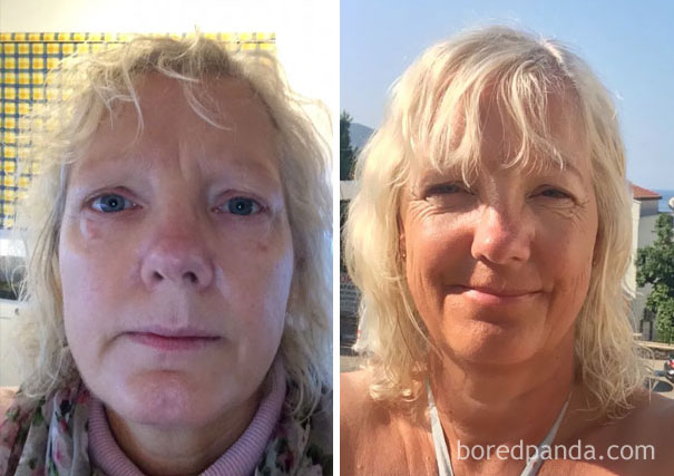 Before and after photos showing the effects of stopping drinking, highlighting positive transformation.