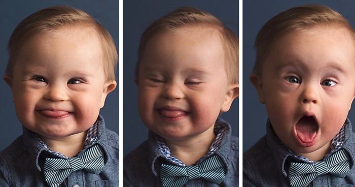 Kid Gets Rejected From Ad Campaign “Because He Has Down’s Syndrome”, Mom Fights Back