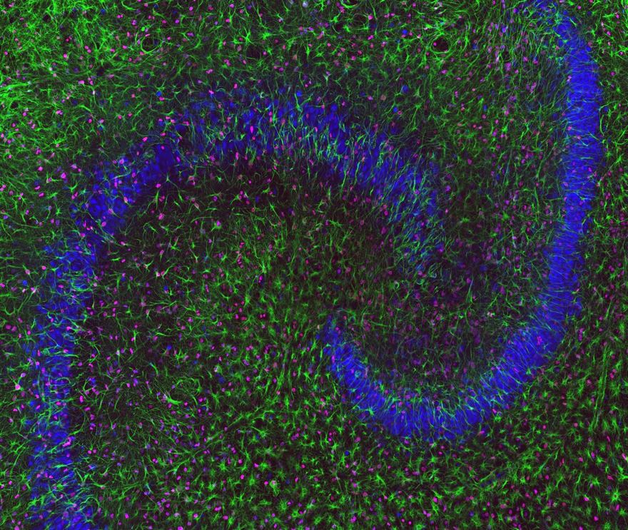 Hippocampal Slice Culture Stained For Neurons