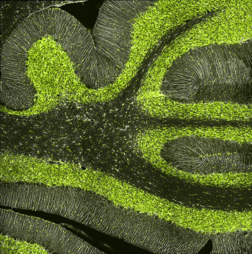 Cerebellum Brain Section Of A Rat