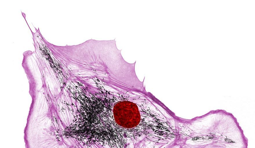Actin, Mitochondria And Dna In A Bovine Pulmonary Artery Endothelial Cell