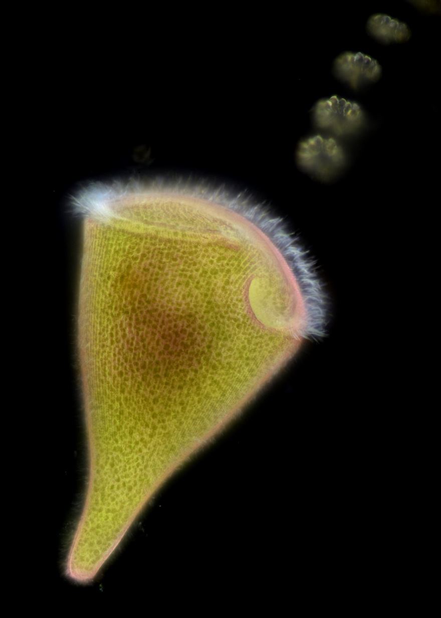 Trumpet Animalcule Containing Endosymbionts