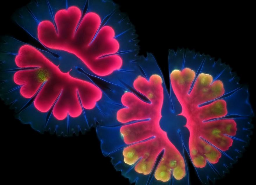 Micrasterias Thomasiana