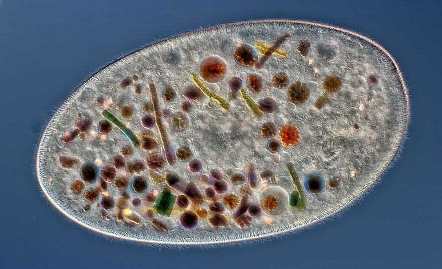 Tenth Place. Frontonia (Showing Ingested Food, Cilia, Mouth And Trichocysts)