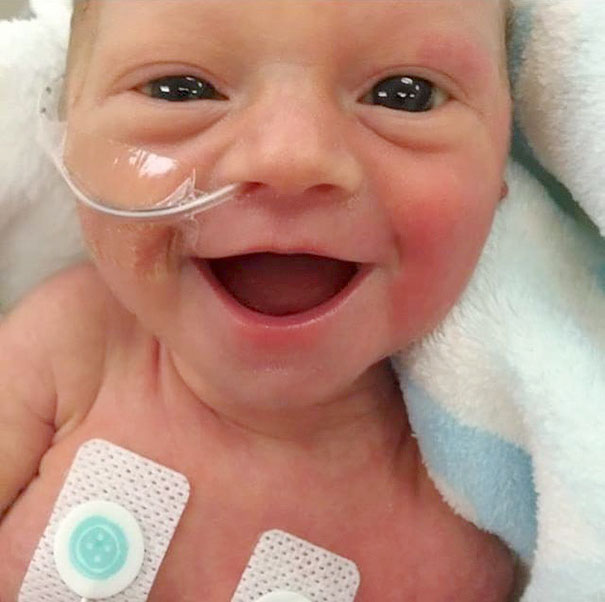 smiling-five-days-old-premature-baby-girl-photo-lauren-vinje-1 smiling-five-days-old-premature-baby-girl-photo-lauren-vinje-1