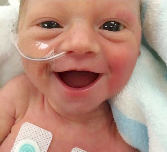 Este bebé prematuro sonríe de oreja a oreja 5 días después de nacer