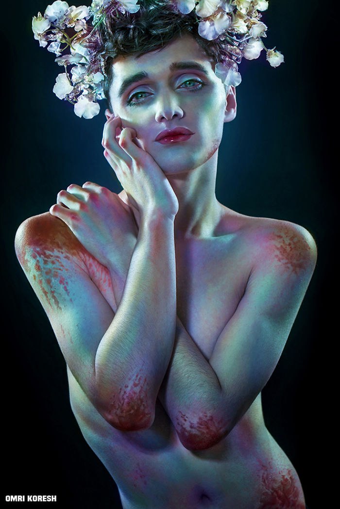 My Photo Series "I'm Not A Doll" Captures The Opposite Of Perfection