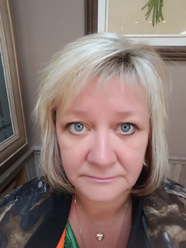 Close-up of a woman showing clear skin and bright eyes as a result of quitting drinking, highlighting before-and-after transformation.