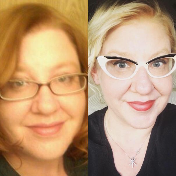 Side-by-side before and after photos of a woman showing changes from when she stopped drinking alcohol.