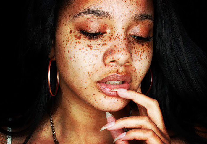 Beautiful Freckles