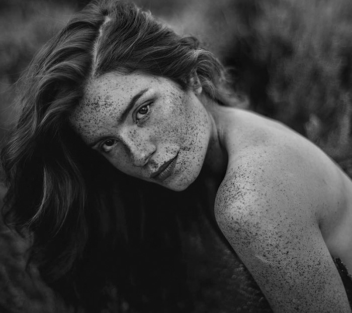 Beautiful Freckles