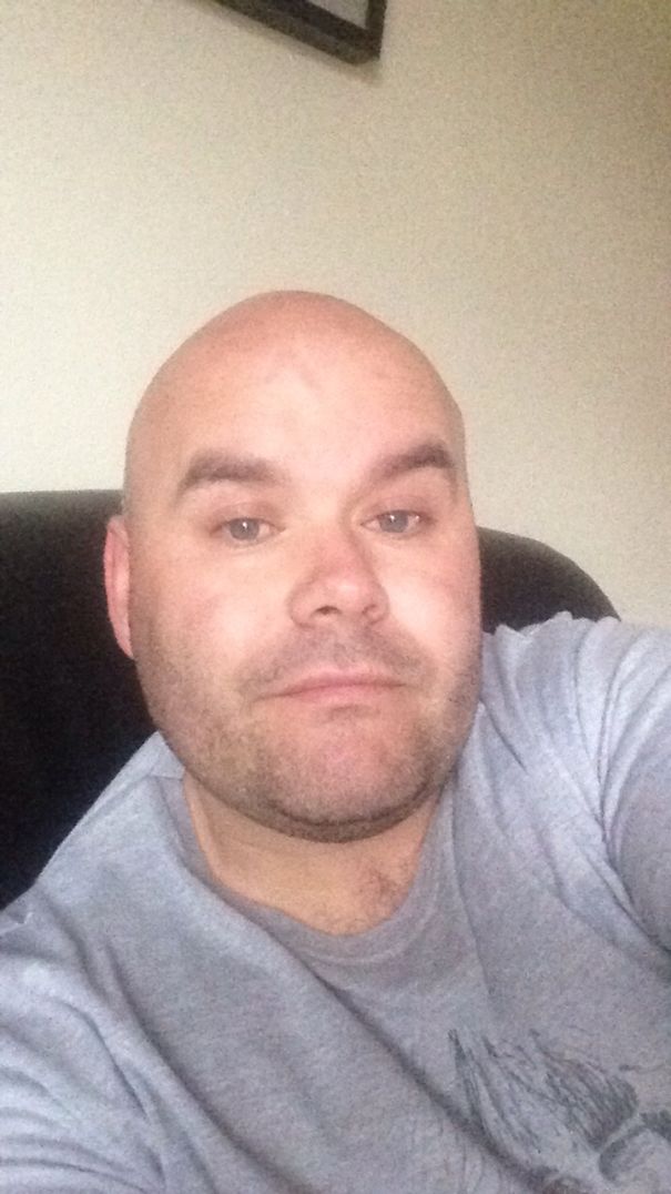 Man with shaved head and light facial hair wearing a gray shirt, part of before and after pics showing what happens when you stop drinking.