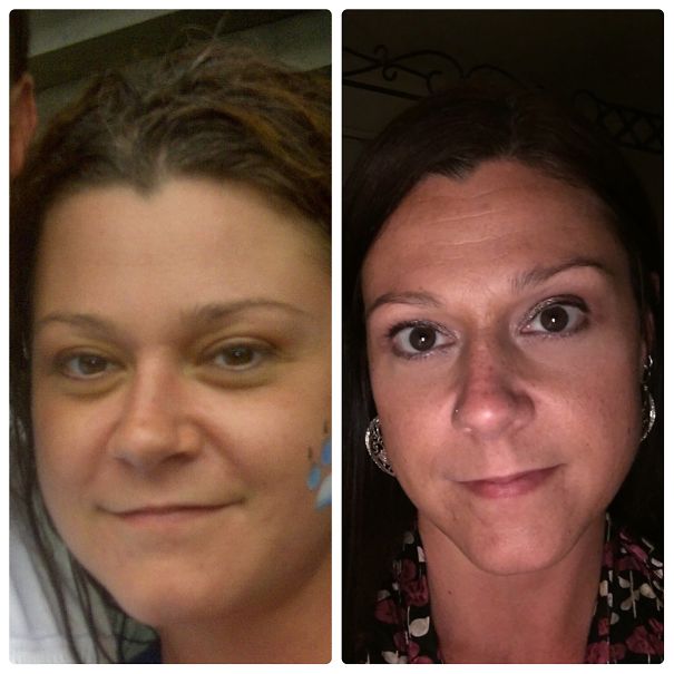 Before and after comparison of woman showing impact of quitting drinking.