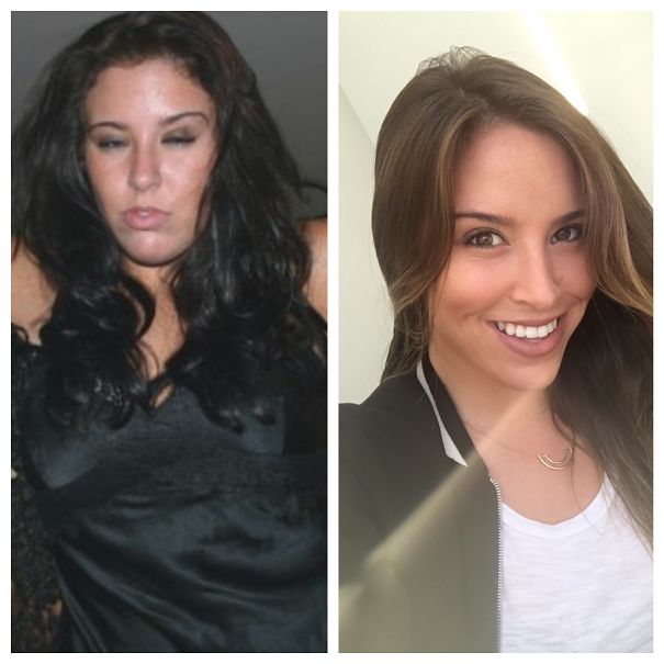 Transformation before-and-after photos show effects of stopping drinking.