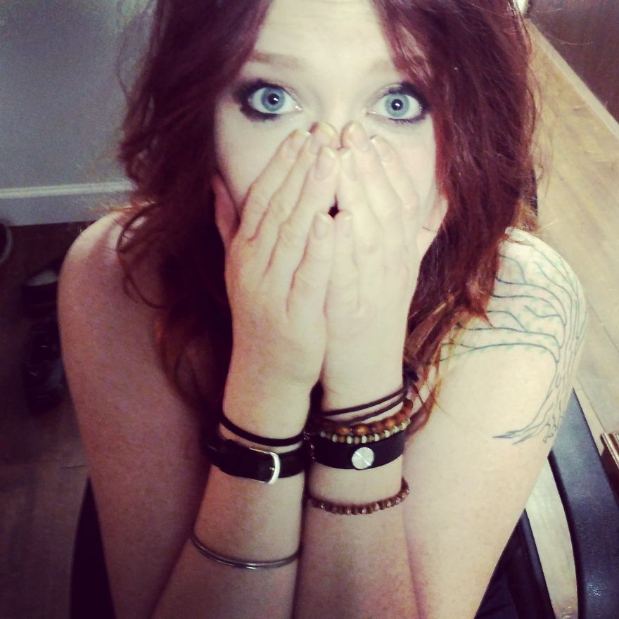 A Red Head Who Recently Cured Her Debilitating Subhorreic Dermatitis Hand Eczema A Red Head Who Recently Cured Her Debilitating Subhorreic Dermatitis Hand Eczema