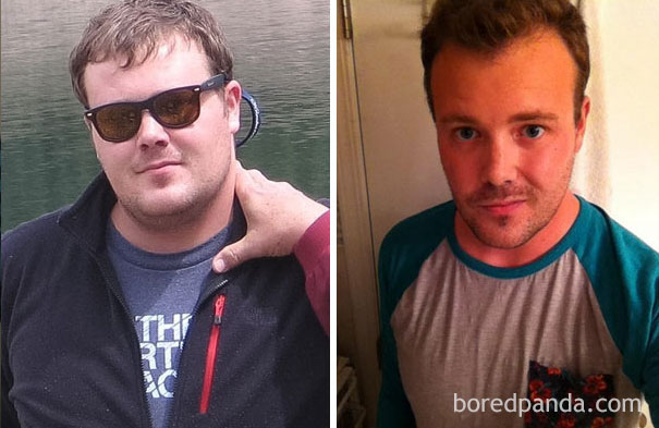Before and after images showing changes from stopping drinking.