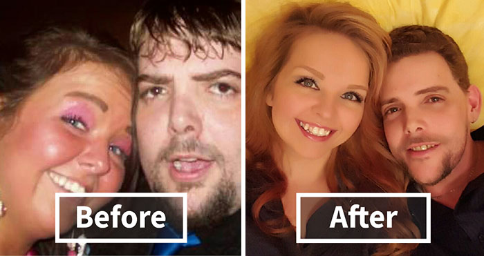 65 Before-And-After Pics Show What Happens When You Stop Drinking (Part 2)