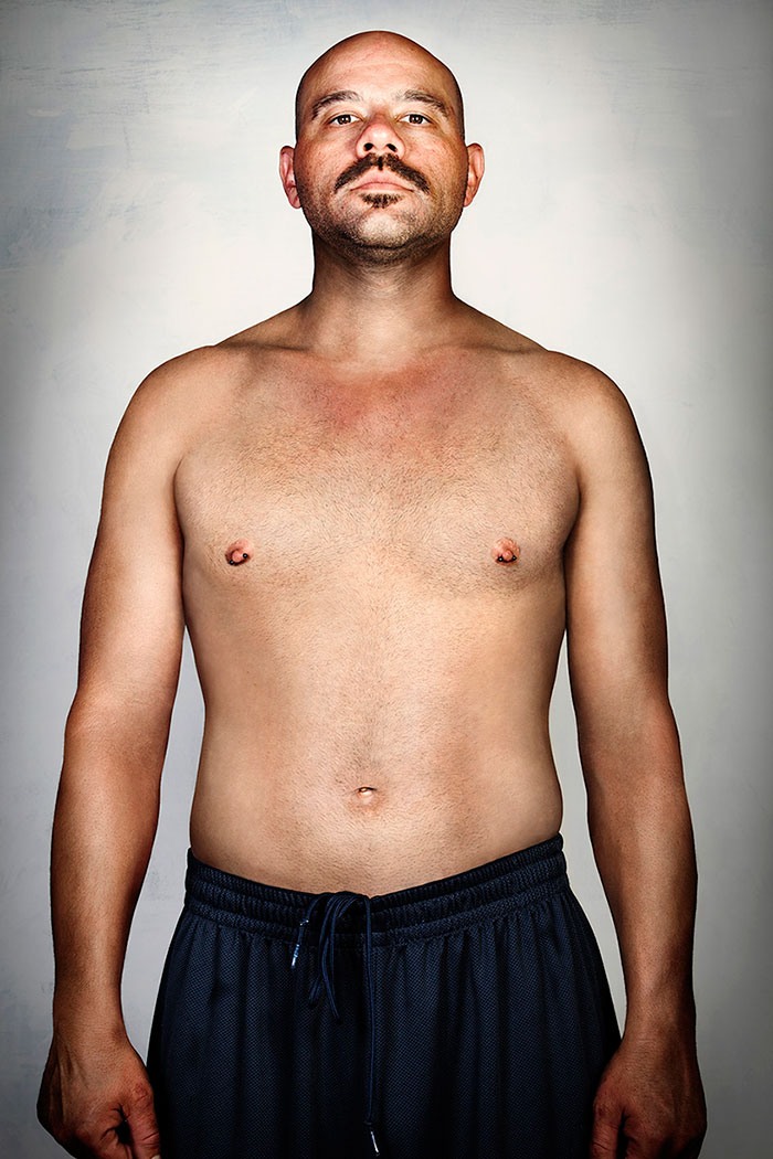 Ex-gang member stands shirtless with tattoos removed, representing transformation and change. Ex-gang member stands shirtless with tattoos removed, representing transformation and change.