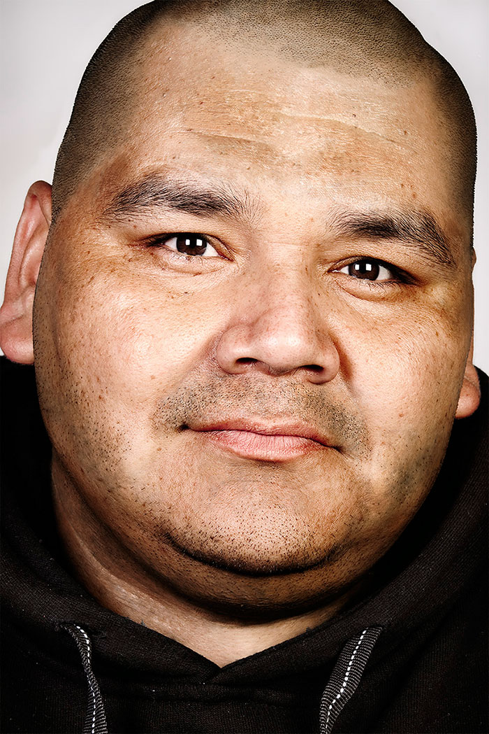 Ex-gang member with tattoos removed, face close-up wearing a black hoodie, showcasing transformation. Ex-gang member with tattoos removed, face close-up wearing a black hoodie, showcasing transformation.