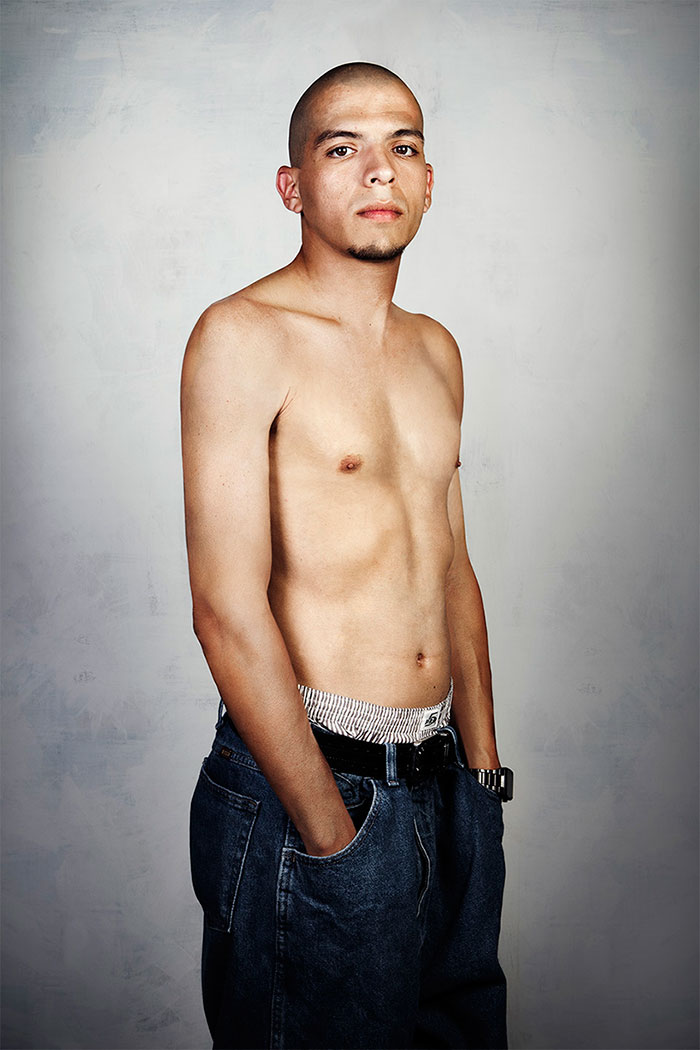 Ex-gang member standing shirtless, showcasing the area where tattoos were removed. Ex-gang member standing shirtless, showcasing the area where tattoos were removed.
