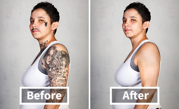 9 Ex-Gang Members With Their Tattoos Removed