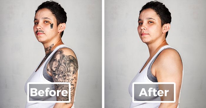 9 Ex-Gang Members With Their Tattoos Removed