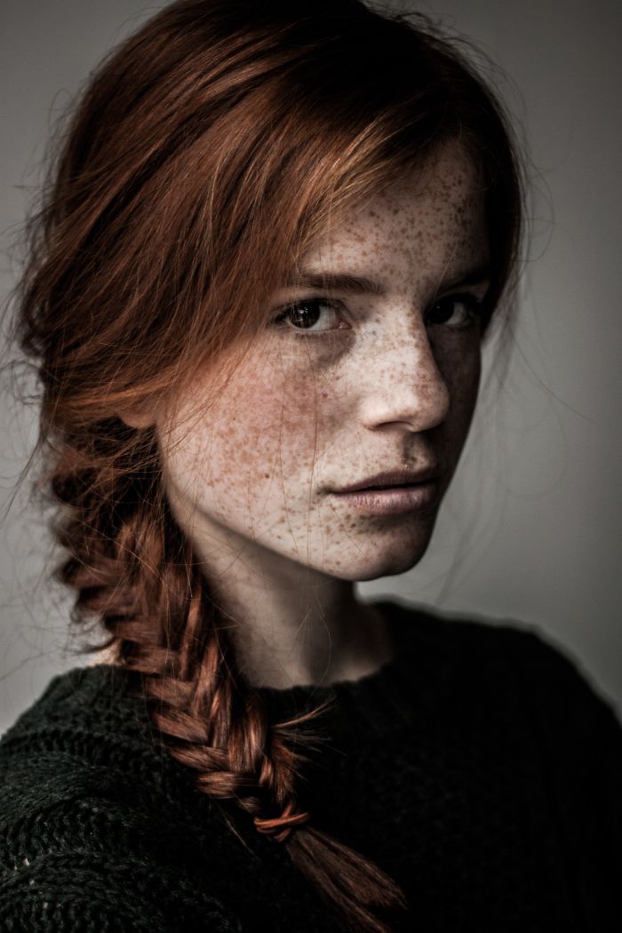 Beautiful Freckles