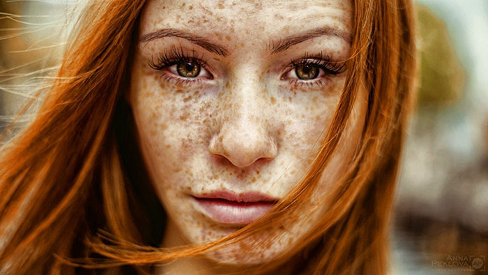 Beautiful Freckles