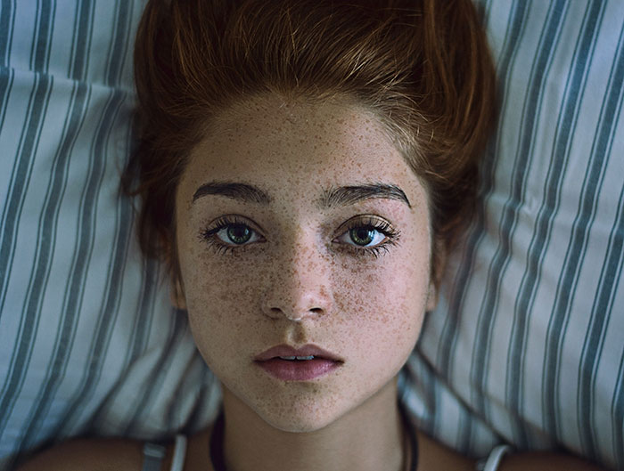 Beautiful Freckles