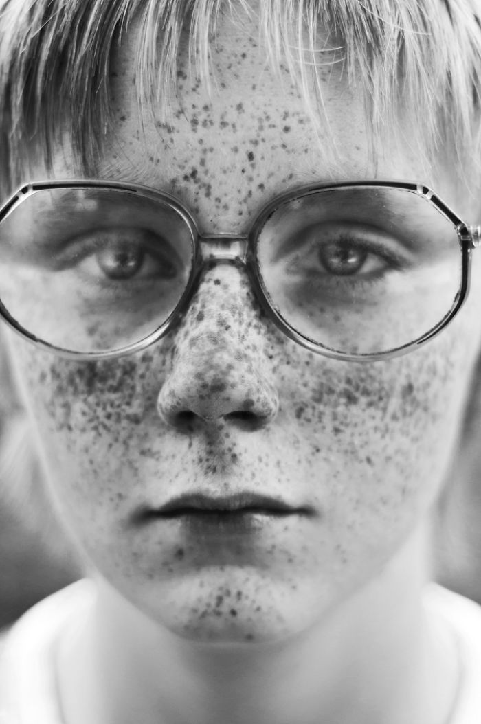 Beautiful Freckles