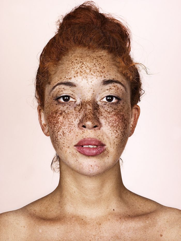 Beautiful Freckles