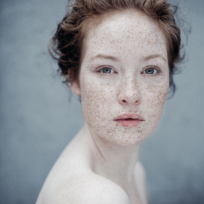 Beautiful Freckles