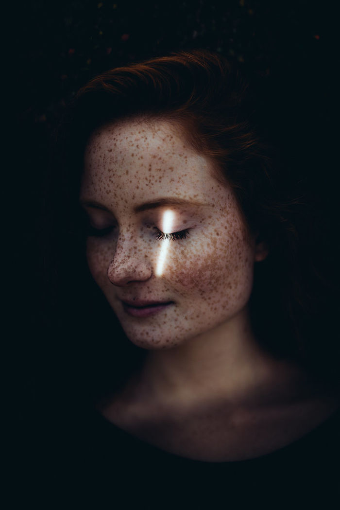 Beautiful Freckles