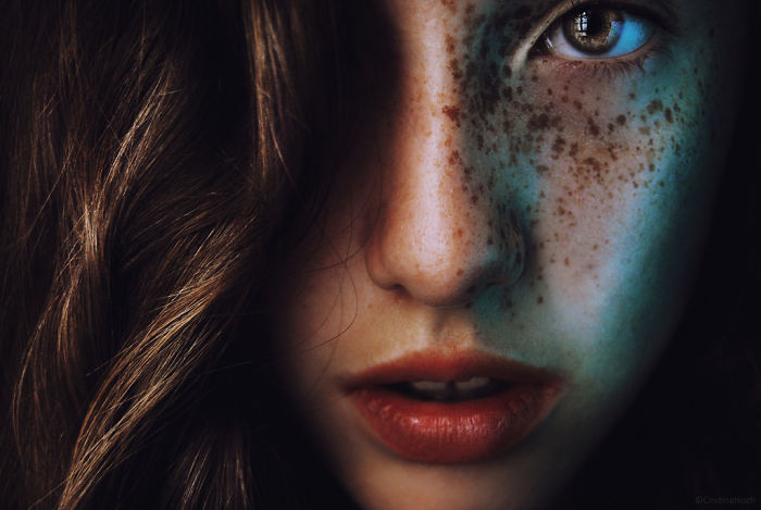 Beautiful Freckles