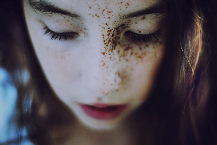 Beautiful Freckles