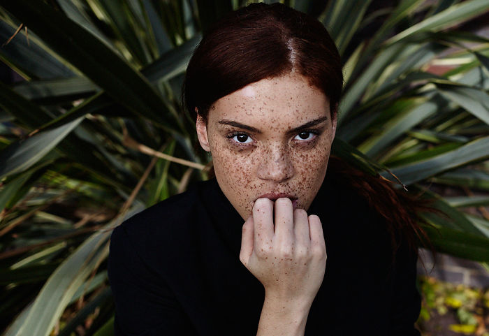 Beautiful Freckles