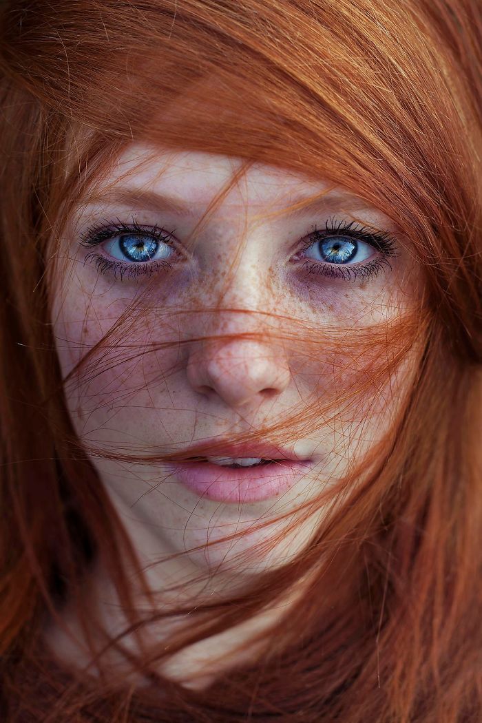 Beautiful Freckles