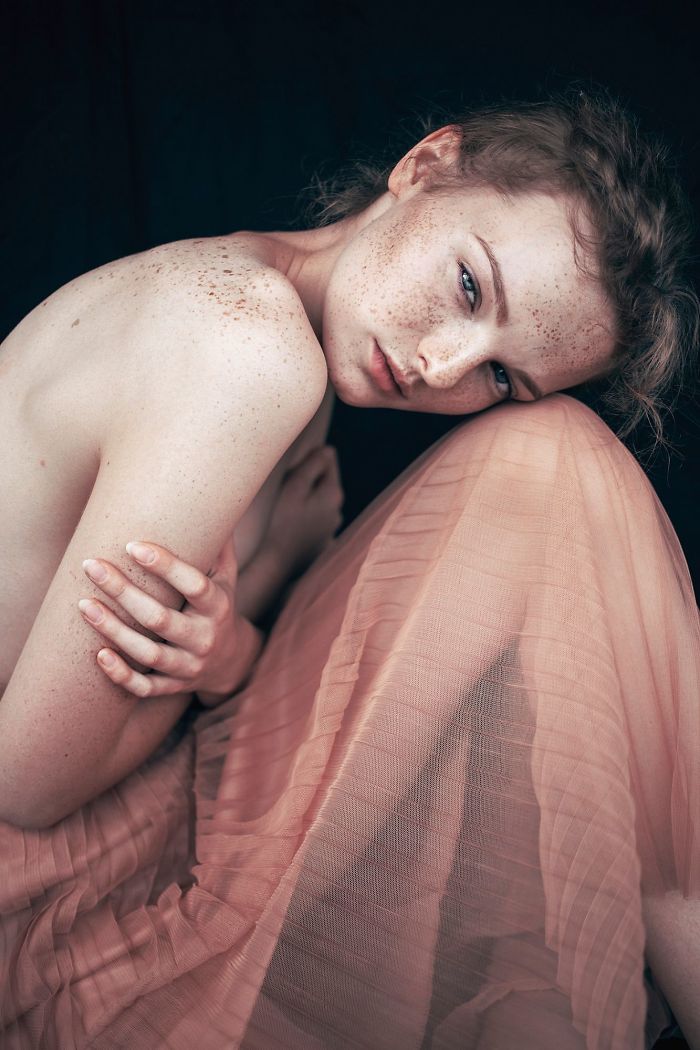 Beautiful Freckles