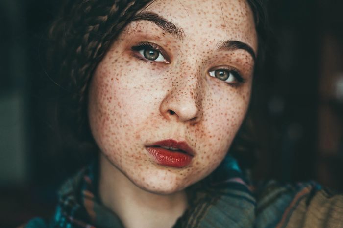 Beautiful Freckles