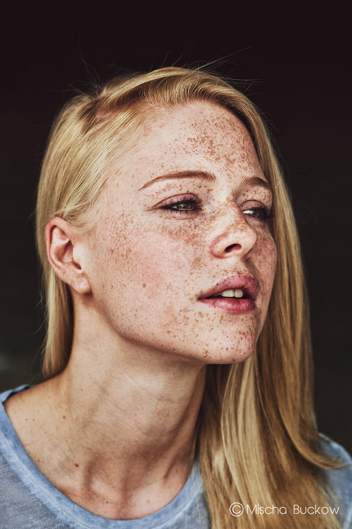 Beautiful Freckles