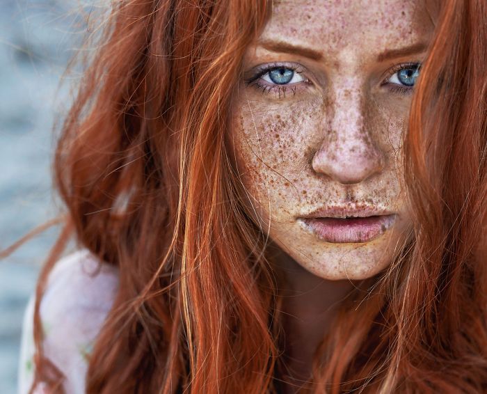 Beautiful Freckles