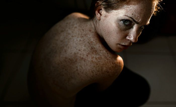 Beautiful Freckles