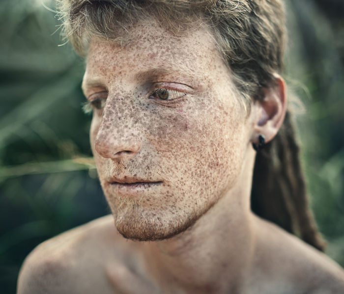 Beautiful Freckles